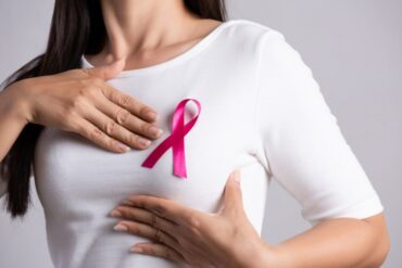 Une étude s’ouvre pour identifier le risque de cancer du sein chez les jeunes femmes