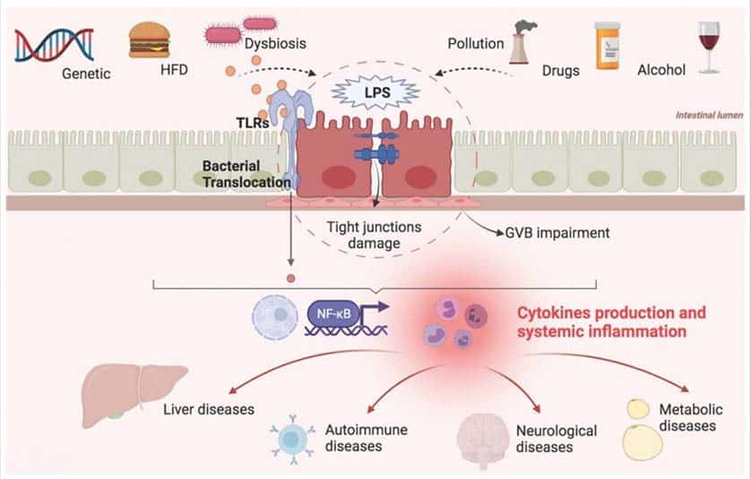 Fig 1 : Facteurs contribuant à l'altération de la barrière intestinale et aux maladies systémiques. HFD : régime riche en graisses ; LPS : lipopolysaccharide ; GVB : barrière vasculaire intestinale ; TLR : récepteurs de type Toll. Réf : Int. J. Environ. Rés. Santé publique 2021 décembre ; 18(23): 12836.